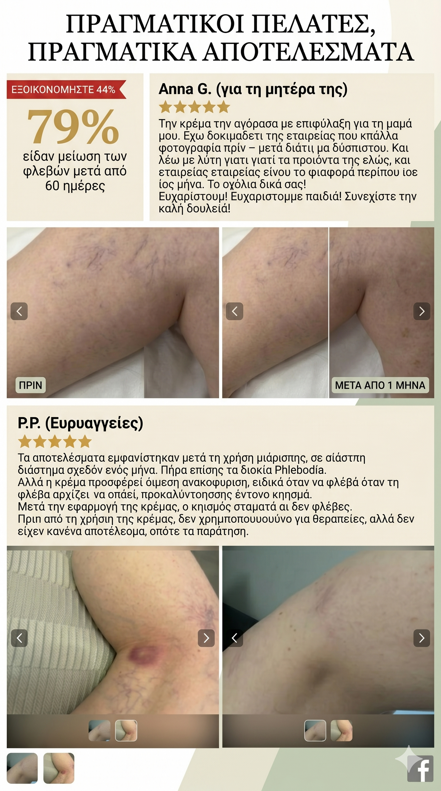 Remorrhoids - κρέμα για Κιρσούς και Αιμορροΐδες - εμπλουτισμένη με Χρυσόξυλο και αγριοκάστανο