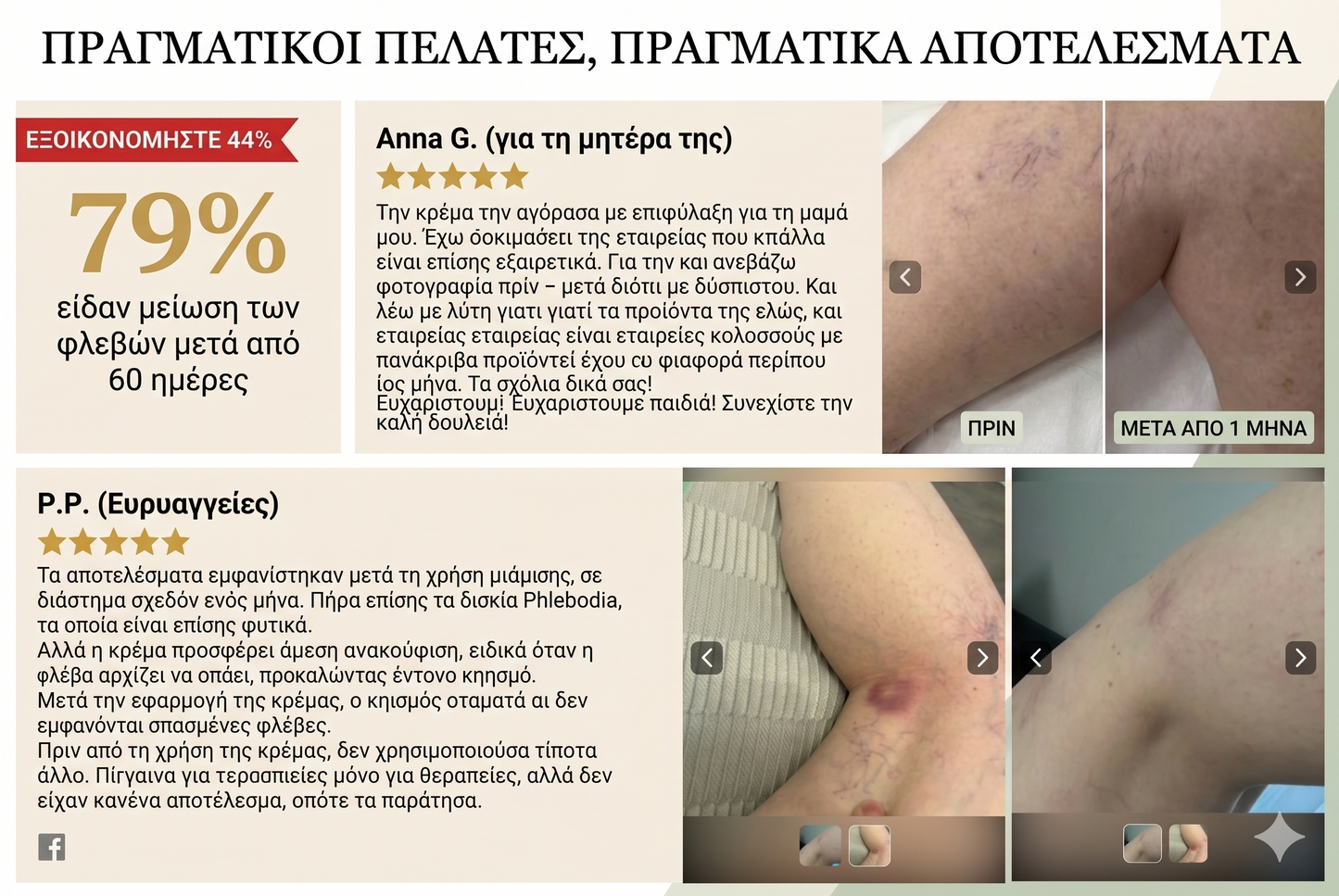 Κιρσοί RoutINA™ - λύση που διαρκεί για τους Kιρσούς