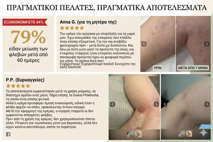 Κιρσοί RoutINA™ - λύση που διαρκεί για τους Kιρσούς