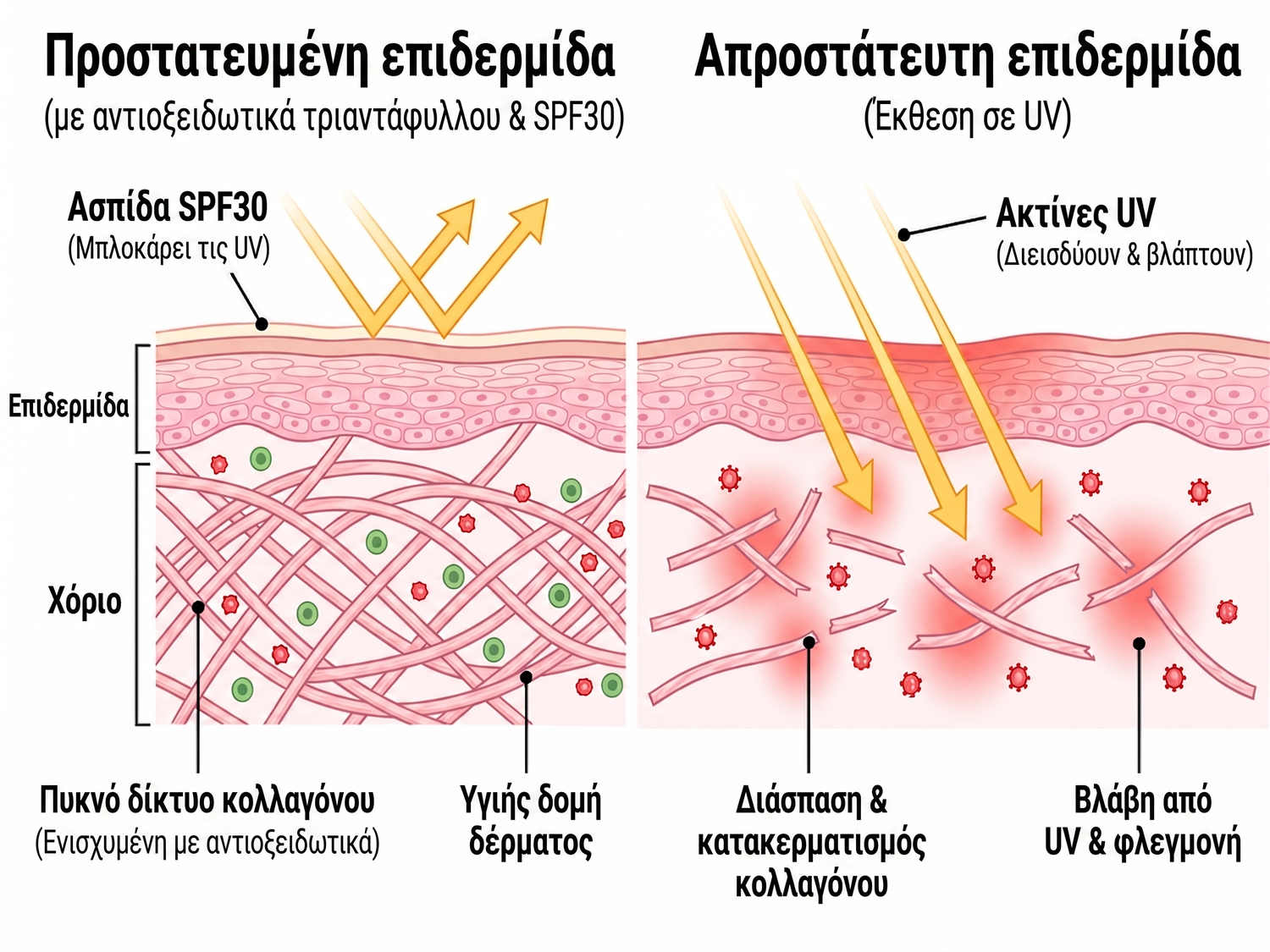 spf GR infographic
